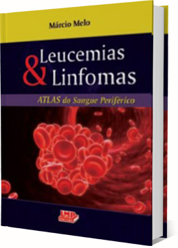 livro-leucemias-linfomas.jpg