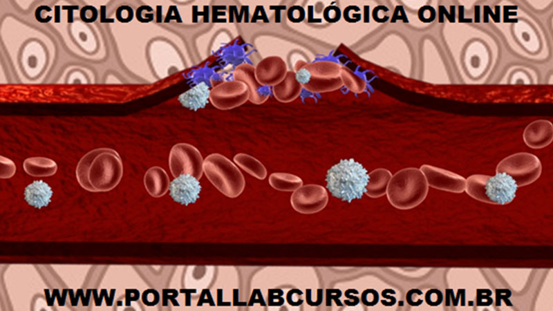 Curso de Hematologia Online